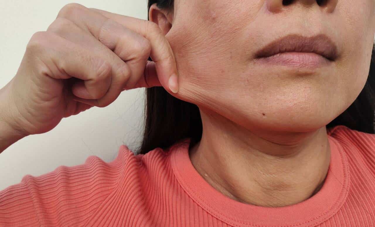 Face de mulher, Flacidez Facial