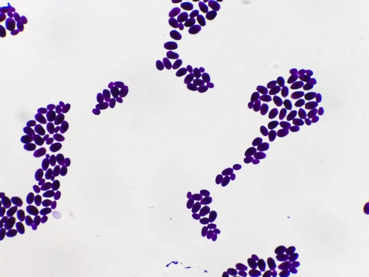 Fungos da Candida auris