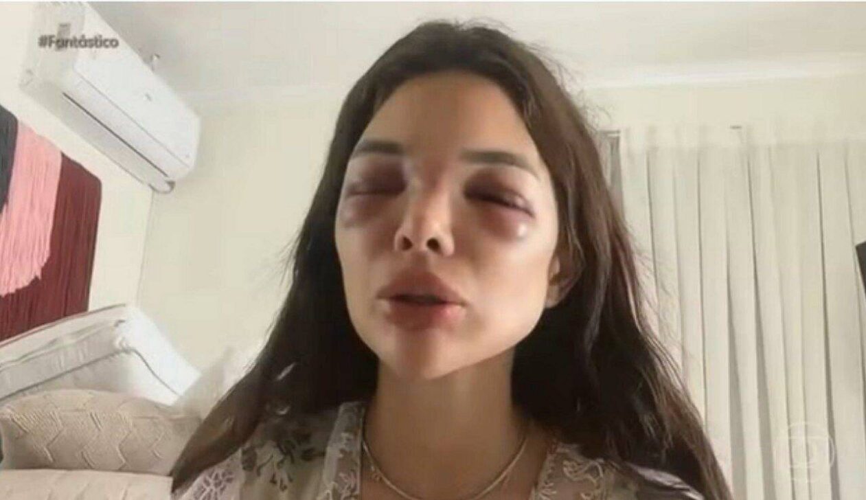 dentista Giulia Falcão Kos - Globo