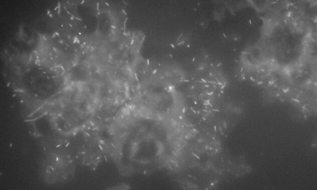 Fungos e tardígrados prospera em reservatórios profundos de gás de xisto - Reprodução/Quinn Moon/Universidade de Michigan