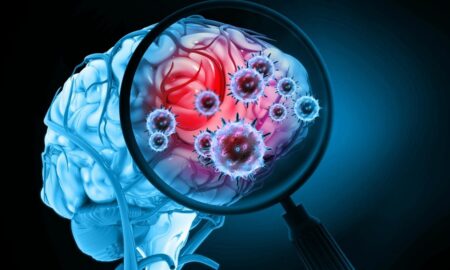 Cérebro, lupa, infecção, vírus - Mohammed Haneefa Nizamudeen/istockphoto