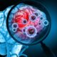 Cérebro, lupa, infecção, vírus - Mohammed Haneefa Nizamudeen/istockphoto