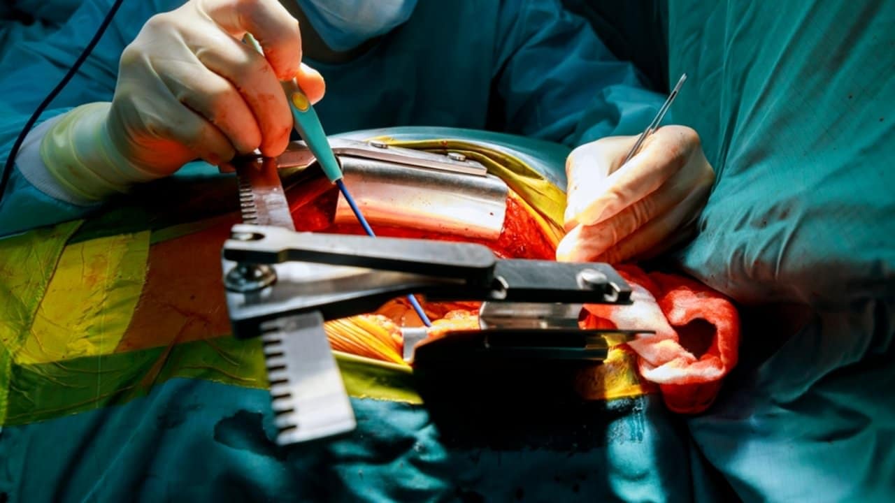 Cirurgia cardíaca, centro cirúrgico - ungvar/ shutterstock.com
