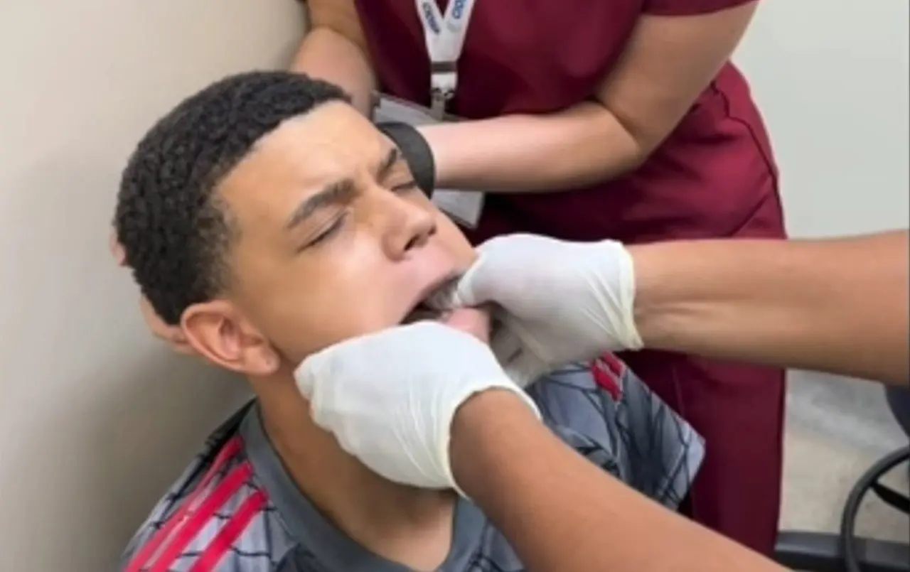 Jovem desloca maxilar - Insatgram
