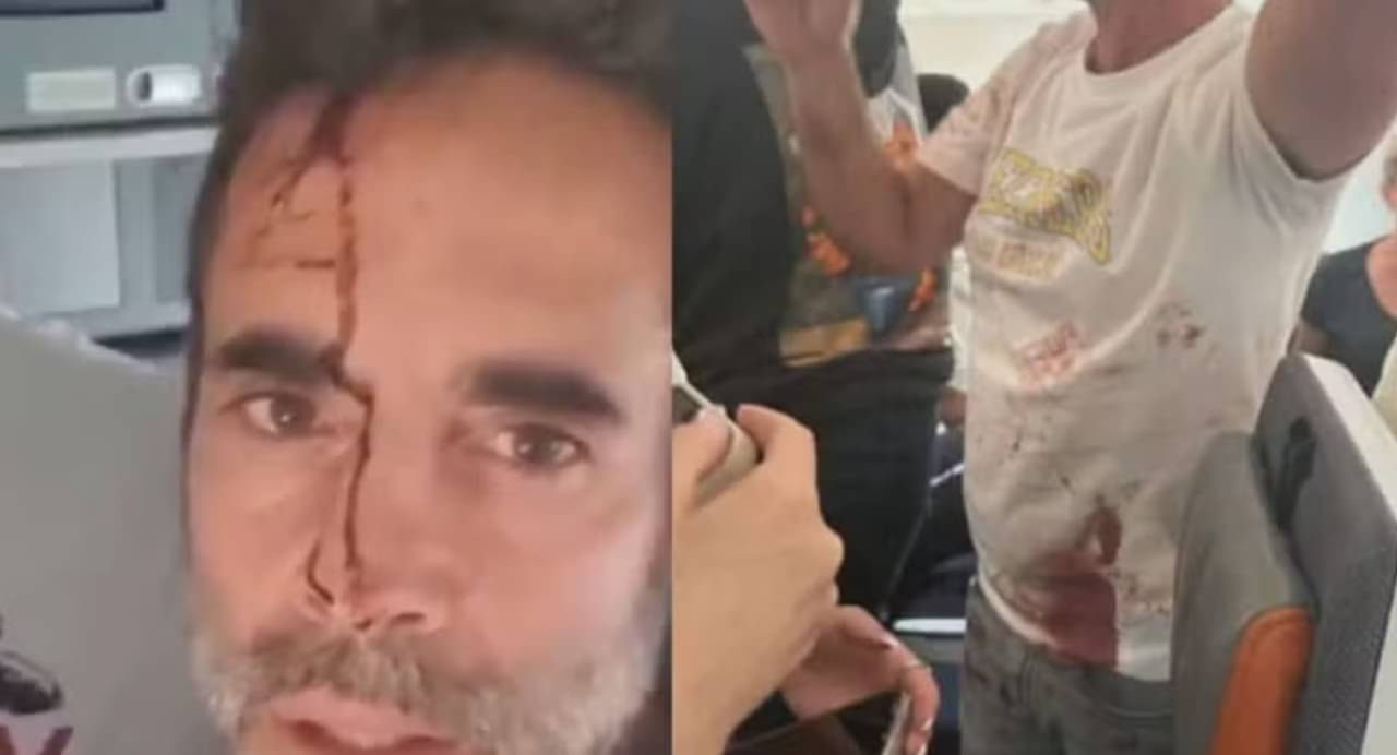 Passageiros ensanguentados após briga entre pilotos em voo da Flydubai - Reprodução/redes sociais