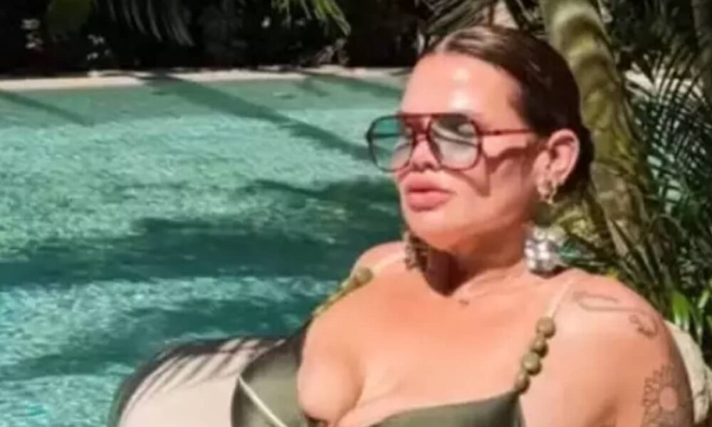 Thais Carla planeja cirurgias para remover excesso de pele