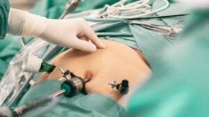 Cirurgiões, cirurgia bariátrica - Portra/ istockphoto.com