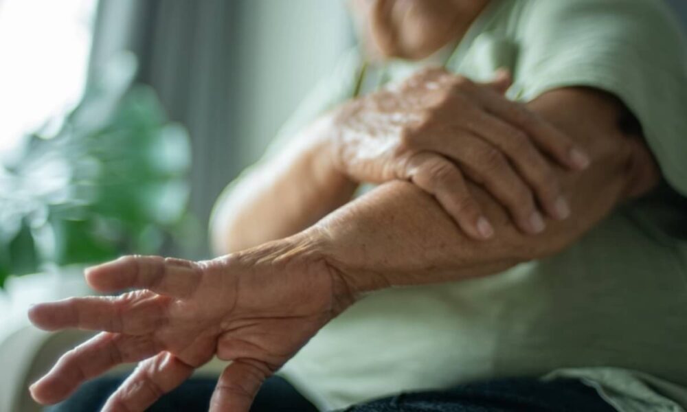 Osteoporose afeta 10 milhões no Brasil sem sinais iniciais