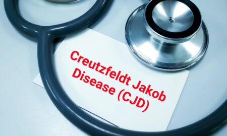 Doença de Creutzfeldt-Jakob teve 547 casos confirmados no país