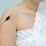 Eletroacupuntura - KAMONRAT/Shutterstock.com
