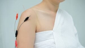 Eletroacupuntura - KAMONRAT/Shutterstock.com