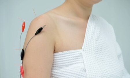 Eletroacupuntura - KAMONRAT/Shutterstock.com