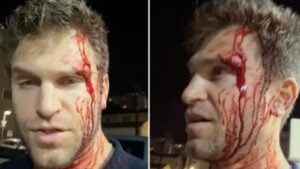 Keegan Allen - Instagram