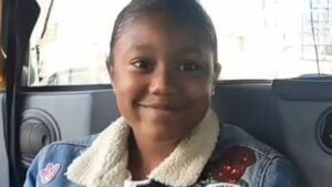 Menina de 12 anos com reação alérgica fatal - Internet
