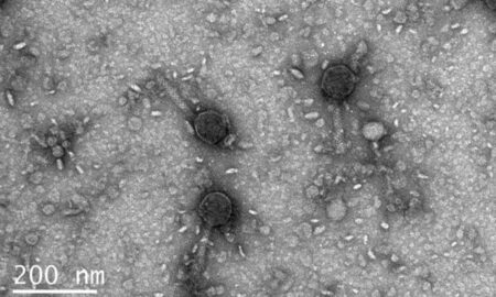 Micrografias de um vírus que carrega proteínas Vipr - Divulgação/Santiago Lopez/Universidade da Califórnia, Berkeley