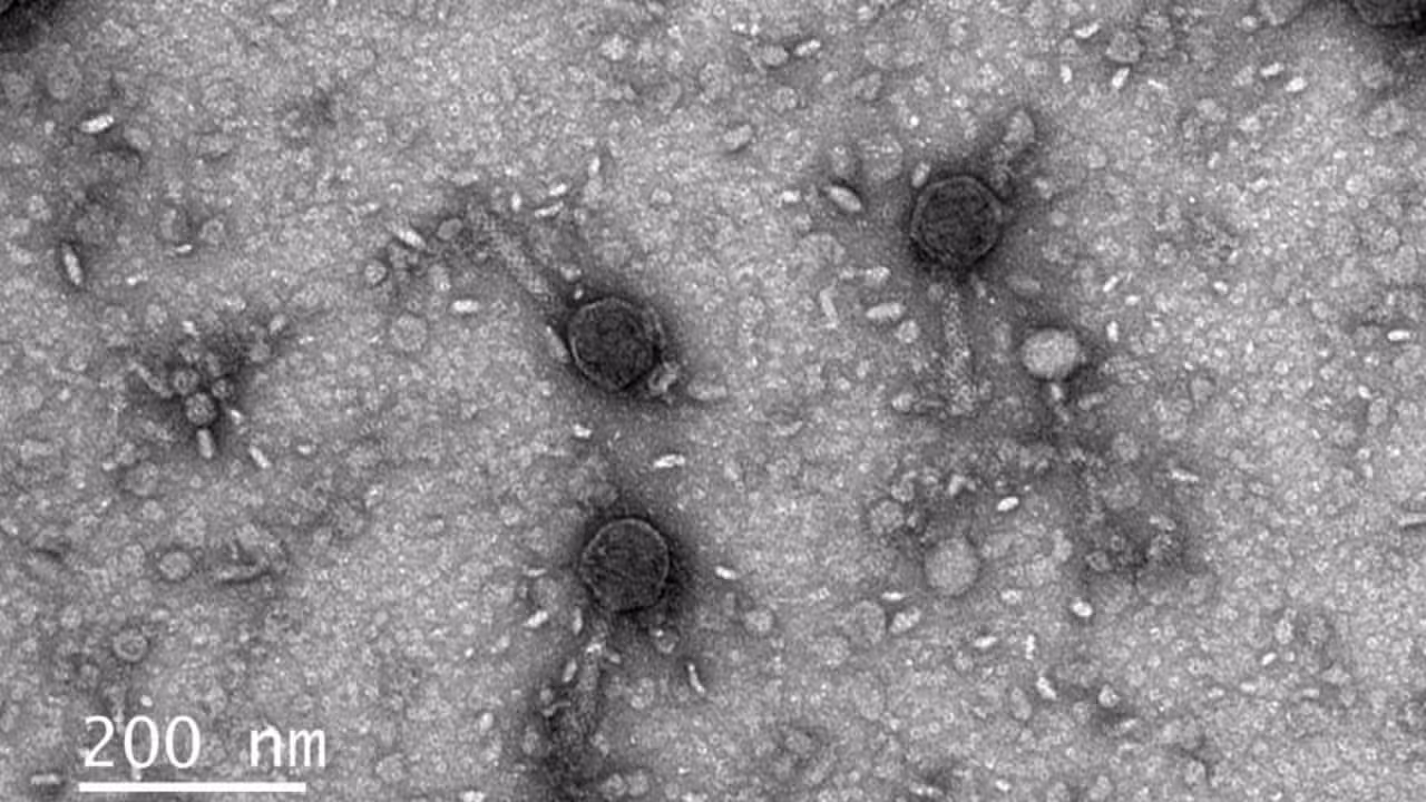 Micrografias de um vírus que carrega proteínas Vipr - Divulgação/Santiago Lopez/Universidade da Califórnia, Berkeley