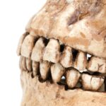 Modelo de dente humano (crânio) - greenleaf123/ istockphoto.com