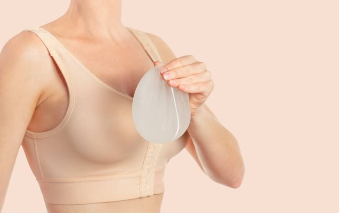 Seio com Silicone - Napoletana/istockphoto.com