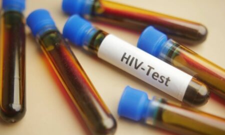 teste de HIV - Towfiqu ahamed barbhuiya/Shutterstock.com