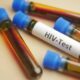 teste de HIV - Towfiqu ahamed barbhuiya/Shutterstock.com
