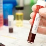 Teste HIV, tubo de sangue - homas Faull/ istockphoto.com