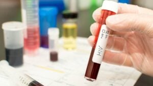 Teste HIV, tubo de sangue - homas Faull/ istockphoto.com