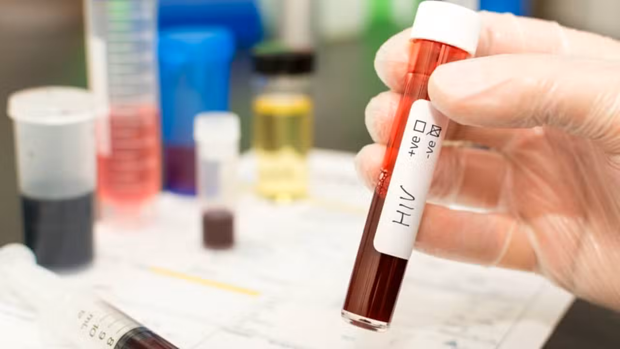 Teste HIV, tubo de sangue - homas Faull/ istockphoto.com
