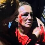 Vereadora Iara Pimentel foi ferida no rosto - Redes sociais