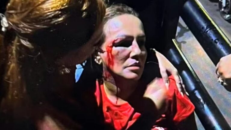 Vereadora Iara Pimentel foi ferida no rosto - Redes sociais